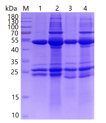 SDS-PAGEzhiduoshao1-kameide.png