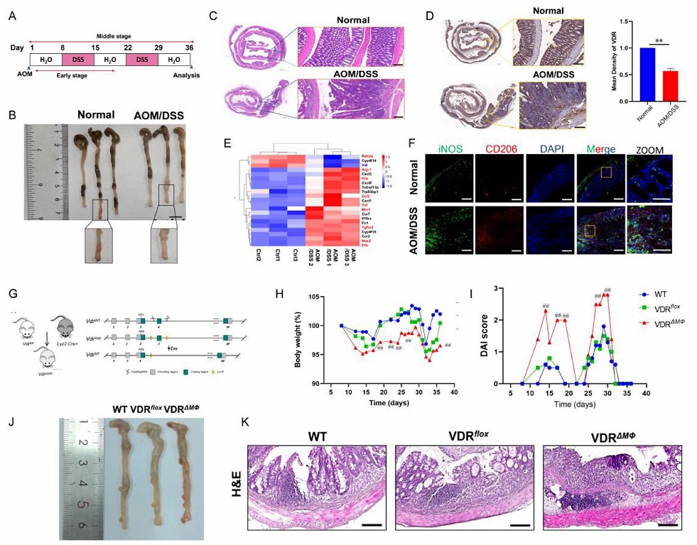 VDR plays an important role in the transformation of chronic intestinal inflammation-induced cancer -01.jpg